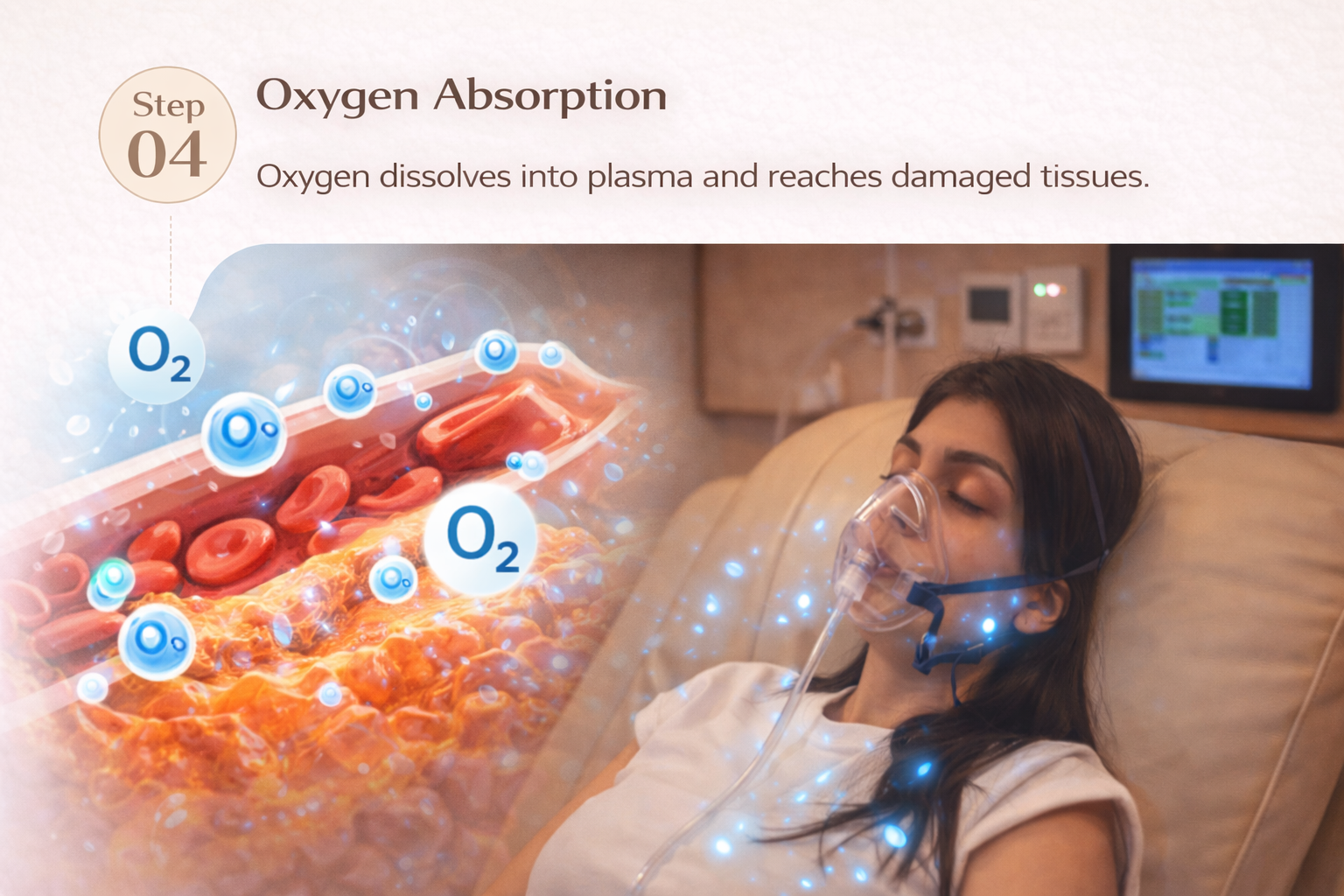 Step 4 - Oxygen Absorption in Plasma